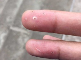 被电了一下立马甩开了(被电了一下是不是当时没事就没事)
